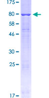 MAC-2-BP / LGALS3BP Protein - 12.5% SDS-PAGE of human LGALS3BP stained with Coomassie Blue