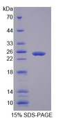 MAC-2-BP / LGALS3BP Protein - Recombinant Lectin Galactoside Binding, Soluble 3 Binding Protein By SDS-PAGE