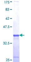 MACF1 Protein - 12.5% SDS-PAGE Stained with Coomassie Blue