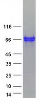 MACROD2 Protein - Purified recombinant protein MACROD2 was analyzed by SDS-PAGE gel and Coomassie Blue Staining