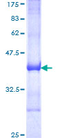 MACS / RIN2 Protein - 12.5% SDS-PAGE Stained with Coomassie Blue.