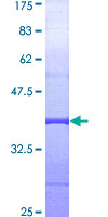 MAD1L1 / MAD1 Protein - 12.5% SDS-PAGE Stained with Coomassie Blue.