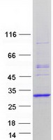 MAD2B / REV7 Protein - Purified recombinant protein MAD2L2 was analyzed by SDS-PAGE gel and Coomassie Blue Staining