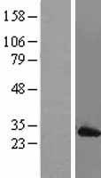 MAD2L1 / MAD2 Protein - Western validation with an anti-DDK antibody * L: Control HEK293 lysate R: Over-expression lysate