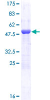 MAD2L1 / MAD2 Protein - 12.5% SDS-PAGE of human MAD2L1 stained with Coomassie Blue