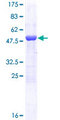 MAD2L1 / MAD2 Protein - 12.5% SDS-PAGE of human MAD2L1 stained with Coomassie Blue