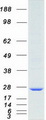 MAD2L1 / MAD2 Protein - Purified recombinant protein MAD2L1 was analyzed by SDS-PAGE gel and Coomassie Blue Staining