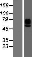 MAdCAM-1 Protein - Western validation with an anti-DDK antibody * L: Control HEK293 lysate R: Over-expression lysate