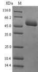 MAdCAM-1 Protein - (Tris-Glycine gel) Discontinuous SDS-PAGE (reduced) with 5% enrichment gel and 15% separation gel.
