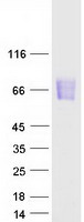 MAdCAM-1 Protein - Purified recombinant protein MADCAM1 was analyzed by SDS-PAGE gel and Coomassie Blue Staining