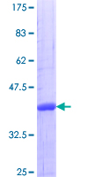 MAEA / EMP Protein - 12.5% SDS-PAGE Stained with Coomassie Blue.