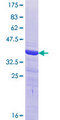 MAFK Protein - 12.5% SDS-PAGE Stained with Coomassie Blue.