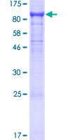 MAG Protein - 12.5% SDS-PAGE of human MAG stained with Coomassie Blue