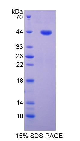 MAG Protein - Recombinant Myelin Associated Glycoprotein By SDS-PAGE