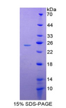 MAG Protein - Recombinant Myelin Associated Glycoprotein By SDS-PAGE