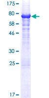 MAGE10 / MAGEA10 Protein - 12.5% SDS-PAGE of human MAGEA10 stained with Coomassie Blue