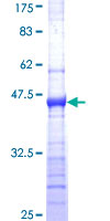 MAGE12 / MAGEA12 Protein - 12.5% SDS-PAGE Stained with Coomassie Blue.