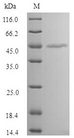 MAGEA1 / MAGE 1 Protein - (Tris-Glycine gel) Discontinuous SDS-PAGE (reduced) with 5% enrichment gel and 15% separation gel.