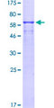 MAGEA1 / MAGE 1 Protein - 12.5% SDS-PAGE of human MAGEA1 stained with Coomassie Blue