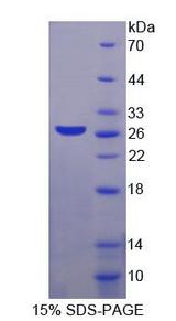 MAGEA1 / MAGE 1 Protein - Recombinant Melanoma Antigen Family A1 (MAGEA1) by SDS-PAGE