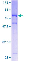 MAGEA11 Protein - 12.5% SDS-PAGE of human MAGEA11 stained with Coomassie Blue