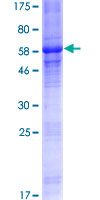 MAGEA2B Protein - 12.5% SDS-PAGE of human MAGEA2B stained with Coomassie Blue