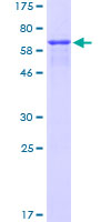 MAGEA3 Protein - 12.5% SDS-PAGE of human MAGEA3 stained with Coomassie Blue