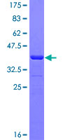 MAGEA3 Protein - 12.5% SDS-PAGE Stained with Coomassie Blue.