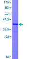 MAGEA3 Protein - 12.5% SDS-PAGE Stained with Coomassie Blue.