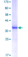MAGEA4 Protein - 12.5% SDS-PAGE Stained with Coomassie Blue.