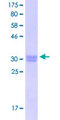 MAGEA5 Protein - 12.5% SDS-PAGE Stained with Coomassie Blue.