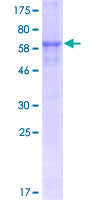 MAGEA6 Protein - 12.5% SDS-PAGE of human MAGEA6 stained with Coomassie Blue