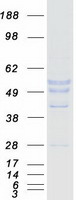 MAGEA8 Protein - Purified recombinant protein MAGEA8 was analyzed by SDS-PAGE gel and Coomassie Blue Staining