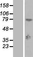 MAGEA9 Protein - Western validation with an anti-DDK antibody * L: Control HEK293 lysate R: Over-expression lysate