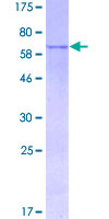 MAGEA9 Protein - 12.5% SDS-PAGE of human MAGEA9 stained with Coomassie Blue