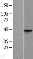 MAGEB1 Protein - Western validation with an anti-DDK antibody * L: Control HEK293 lysate R: Over-expression lysate