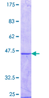 MAGEB1 Protein - 12.5% SDS-PAGE Stained with Coomassie Blue.