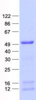 MAGEB1 Protein