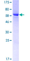 MAGEB10 Protein - 12.5% SDS-PAGE of human MAGEB10 stained with Coomassie Blue