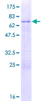MAGEB18 Protein - 12.5% SDS-PAGE of human MAGEB18 stained with Coomassie Blue