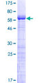 MAGEB2 Protein - 12.5% SDS-PAGE of human MAGEB2 stained with Coomassie Blue