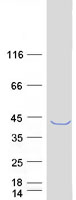 MAGEB2 Protein - Purified recombinant protein MAGEB2 was analyzed by SDS-PAGE gel and Coomassie Blue Staining