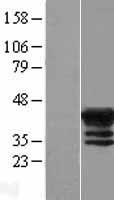 MAGEB4 Protein - Western validation with an anti-DDK antibody * L: Control HEK293 lysate R: Over-expression lysate