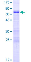MAGEB4 Protein - 12.5% SDS-PAGE of human MAGEB4 stained with Coomassie Blue