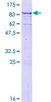 MAGEB6 Protein - 12.5% SDS-PAGE of human MAGEB6 stained with Coomassie Blue