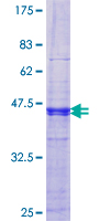 MAGEB6 Protein - 12.5% SDS-PAGE Stained with Coomassie Blue.