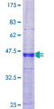 MAGEB6 Protein - 12.5% SDS-PAGE Stained with Coomassie Blue.