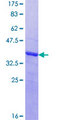 MAGEC1 Protein - 12.5% SDS-PAGE Stained with Coomassie Blue.