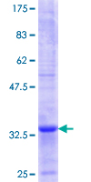MAGEC2 / CT10 Protein - 12.5% SDS-PAGE Stained with Coomassie Blue.