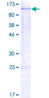 MAGED2 Protein - 12.5% SDS-PAGE of human MAGED2 stained with Coomassie Blue